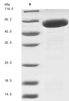 Puromycin-sensitive aminopeptidase (NPEPPS), partial, human, recombinant