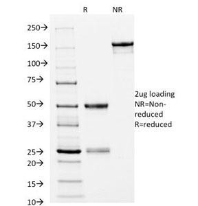 Anti-HLA-DRB1 (MHC II), clone L243