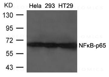 Anti-NFkB-p65 (Ab-468)
