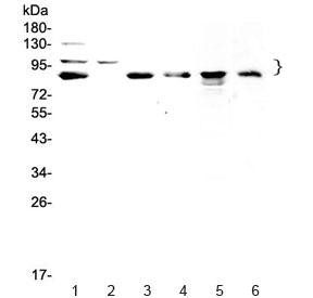 Anti-TPX2 / Targeting protein for Xklp2 / p100