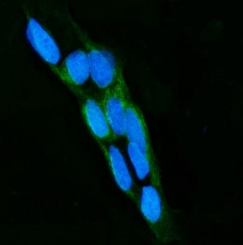 Anti-Lactoperoxidase