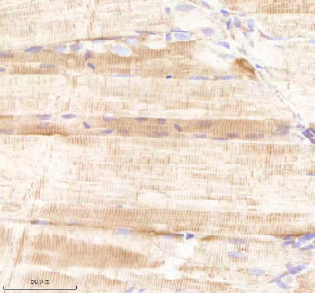 Anti-Zebrafish Sars1 / Serine-tRNA ligase / SerRS
