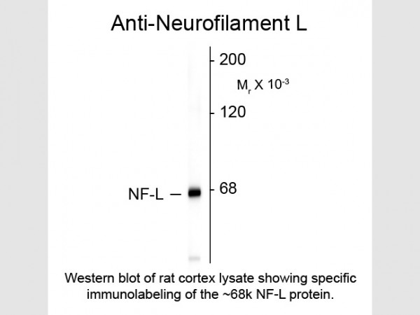 Anti-Neurofilament L