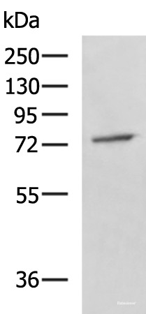 Anti-GPCPD1