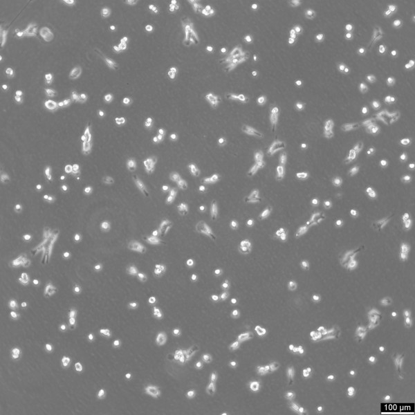TM4 Cells