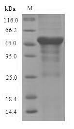 Serine--pyruvate aminotransferase, mitochondrial (Agxt), mouse, recombinant