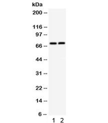 Anti-TNF Receptor II / TNFR2