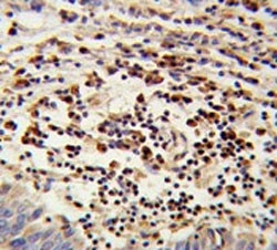 Anti-Mitochondrial amidoxime reducing component 2 / mARC2 / MTARC2