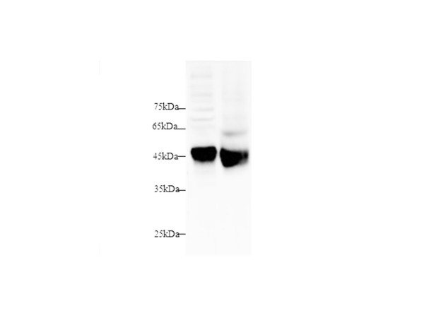Anti-SFTPD/SP-D