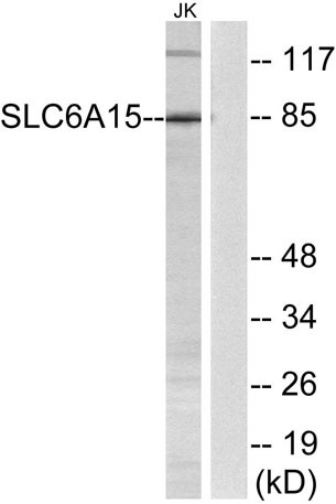 Anti-SLC6A15