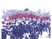 Anti-Apoptosis Inducing Factor (AIF)