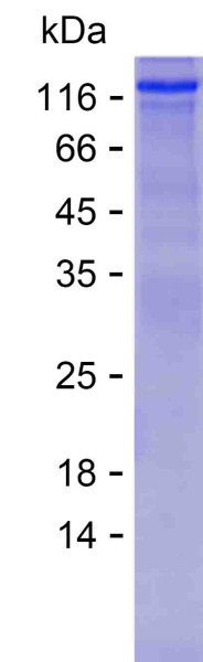MORC3 (human), recombinant protein