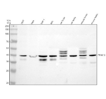 Anti-TRIM13 / Tripartite motif-containing protein 13