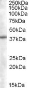 Anti-SNX16, N-terminal