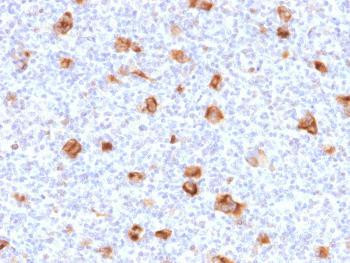 Anti-Bcl-X (Apoptosis Marker) Monoclonal Antibody (Clone: SPM519)