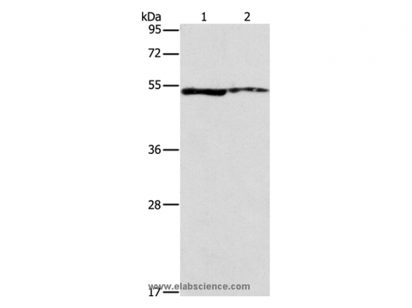 Anti-ALDH3A1