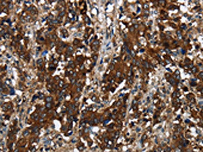 Anti-GLIPR1