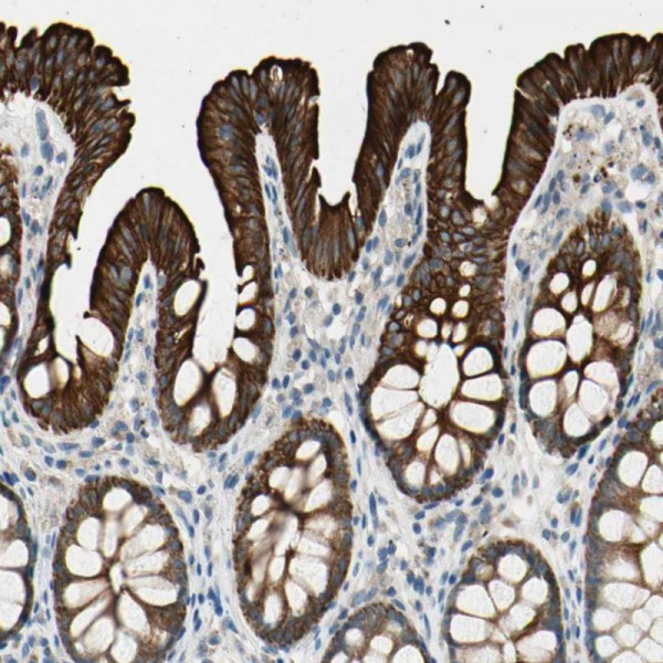 Anti-DUSP12