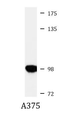 Anti-INPP4B