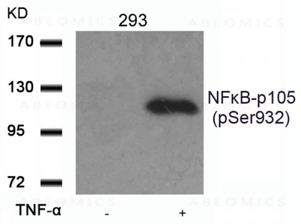 Anti-phospho-NFkB-p105/p50 (Ser932)