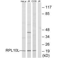 Anti-RPL10L