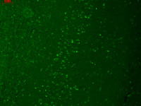Anti-TRPM7, clone S74-25
