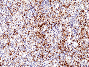 Anti-Integrin beta3 (human), Rabbit Monoclonal (RM382)