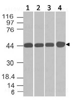 Anti-NDRG1 (Clone: ABM51C9 )