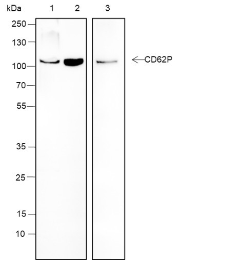 Anti-Recombinant CD62P, clone A180
