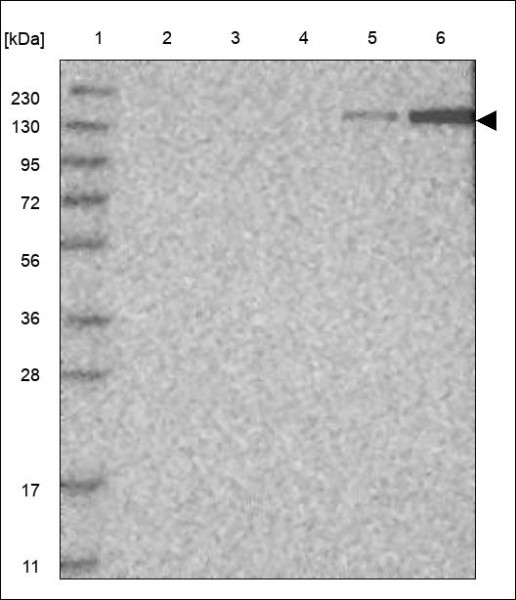 Anti-COL6A1