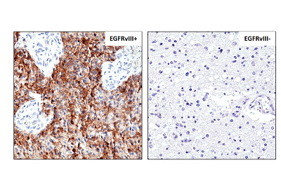 Anti-EGFRvIII (human), Rabbit Monoclonal (RM419)