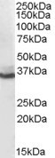 Anti-AKR1C4, N-terminal
