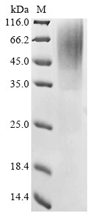 Reticulon-3 (Rtn3), partial, mouse, recombinant
