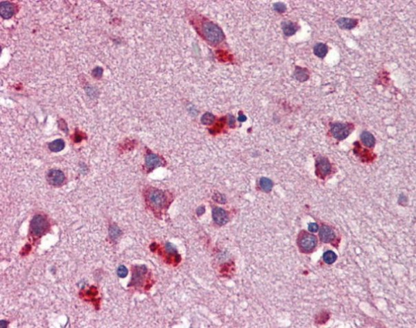 Anti-Wnt7b