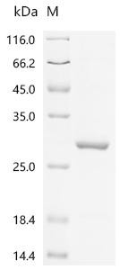 Leucine-rich PPR motif-containing protein, mitochondrial (LRPPRC), partial, recombinant human