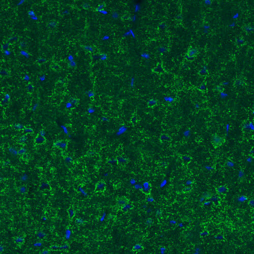 Anti-GAD1, clone CL2914