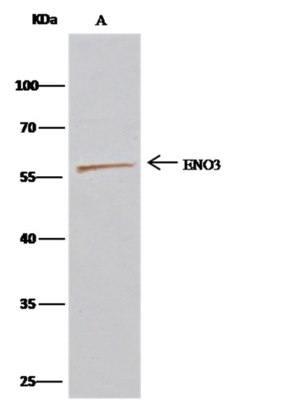 Anti-ENO3/beta-enolase Monoclonal Recombinant Antibody