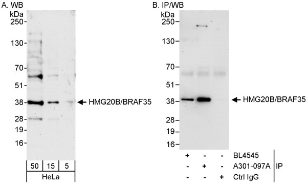 Anti-HMG20B/BRAF35
