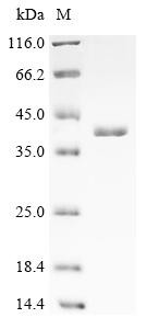 ER membrane protein complex subunit 10 (EMC10), partial, human, recombinant