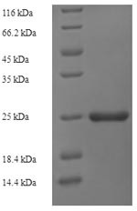 ESAT-6-like protein EsxH (esxH), partial, Mycobacterium tuberculosis, recombinant