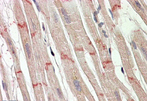 Anti-Desmoplakin (aa 1672 -1684), Internal