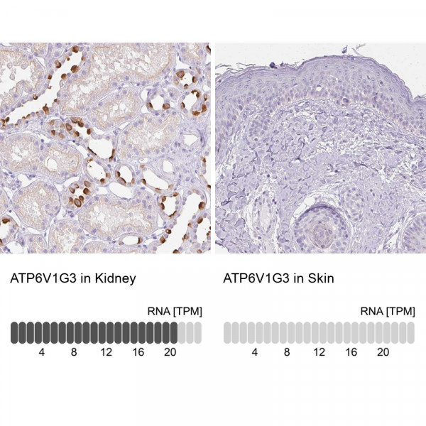 Anti-ATP6V1G3