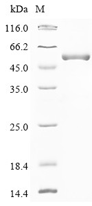 Adenosine deaminase CECR1 (CECR1), partial, human, recombinant