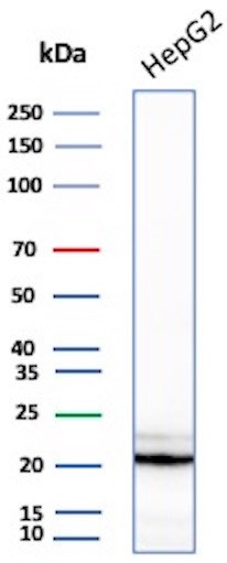 Anti-p21WAF1 (Tumor Suppressor Protein), clone AC8