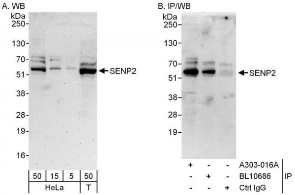 Anti-SENP2
