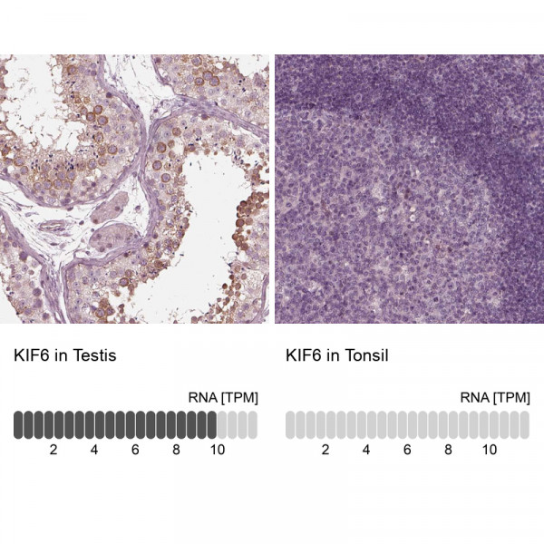 Anti-KIF6