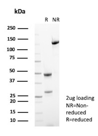 Anti-Alkaline Phosphatase (Tissue-Nonspecific), clone SPM372