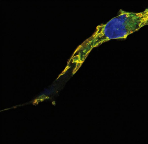 Anti-RRAS2 / TC21, clone EM-50