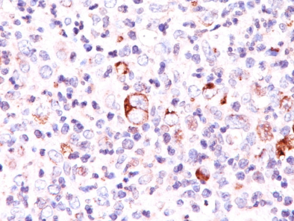 Anti-Bcl-X (Apoptosis Marker), clone SPM165