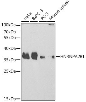 Anti-HNRNPA2B1